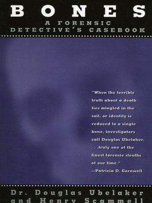 cover image of Bones